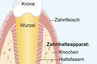 Zahnhalteapparat Zahnhalteapparat